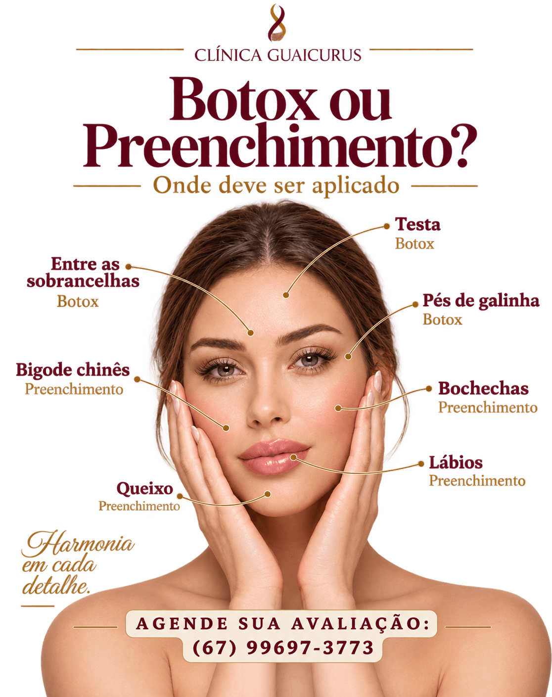 Arte explicando onde aplicar botox (testa, entre as sobrancelhas e pés de galinha) e preenchimento (bigode chinês, bochechas, lábios e queixo)